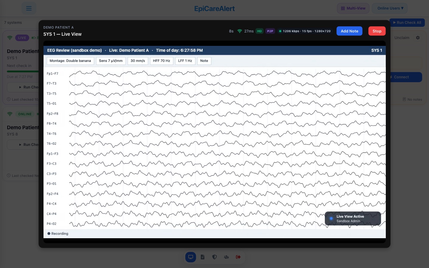 Live view of a simulated EEG workstation: sixteen EEG channels scrolling, with the connection quality, Add Note and Stop controls above, and a badge on the workstation showing that a technologist is connected.